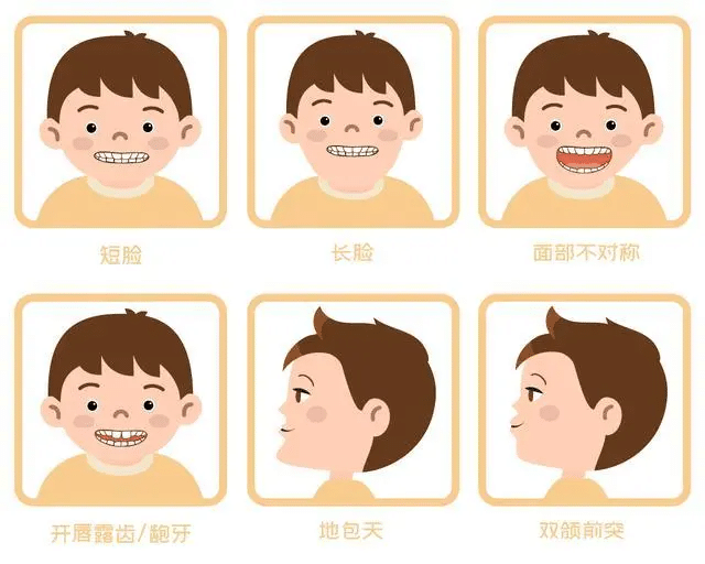 请注意！儿童歪牙早干预和晚矫正，可能会差很多